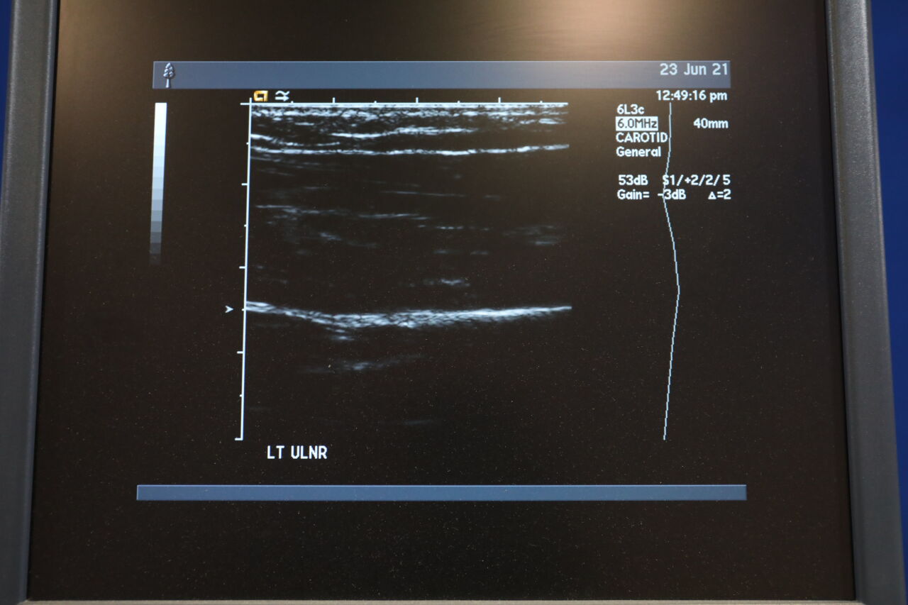 ACUSON Sequoia C256 Ultrasound Machine
