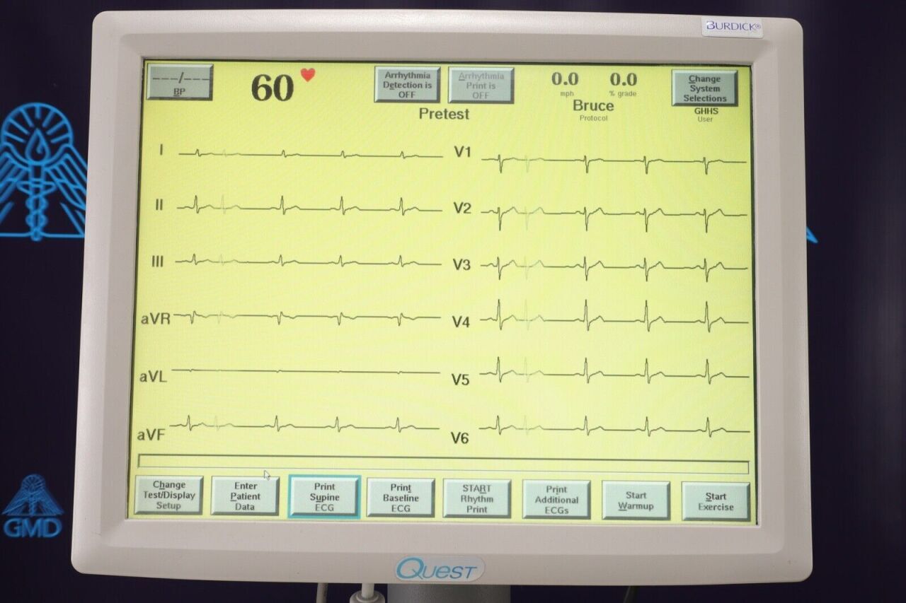 CARDIAC SCIENCE MHHS Stress Test