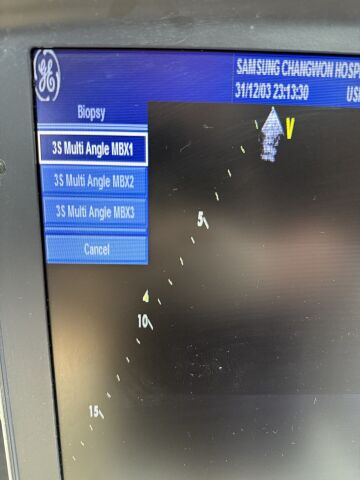 GE Vivid i with Convex 4CRS  Cardiac 3SRS Two Probe Ultrasound OB / GYN