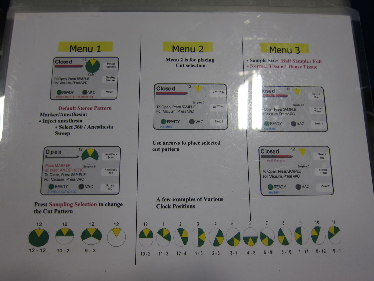 SENORX VS3000 Biopsy Unit