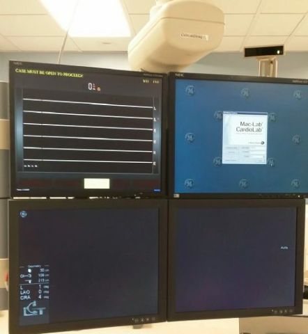 GE HEALTHCARE 2006 GE INNOVA 3100 IQ Cath Lab