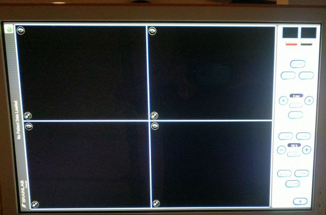 BRAINLAB Curve Image Guided Surgery Dual Monitors Surgical Navigation System