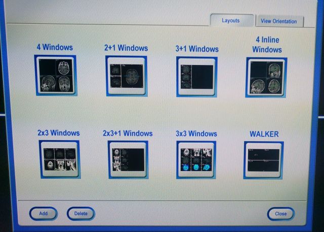 BRAINLAB Curve Image Guided Surgery Dual Monitors Surgical Navigation System