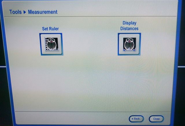 BRAINLAB Curve Image Guided Surgery Dual Monitors Surgical Navigation System