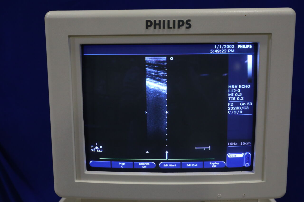PHILIPS Envisor C Ultrasound Machine