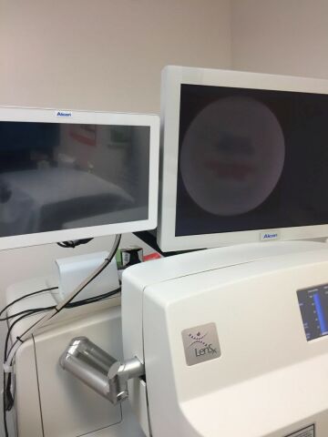 ALCON LenSx Laser - Femto