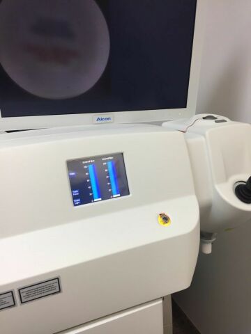ALCON LenSx Laser - Femto