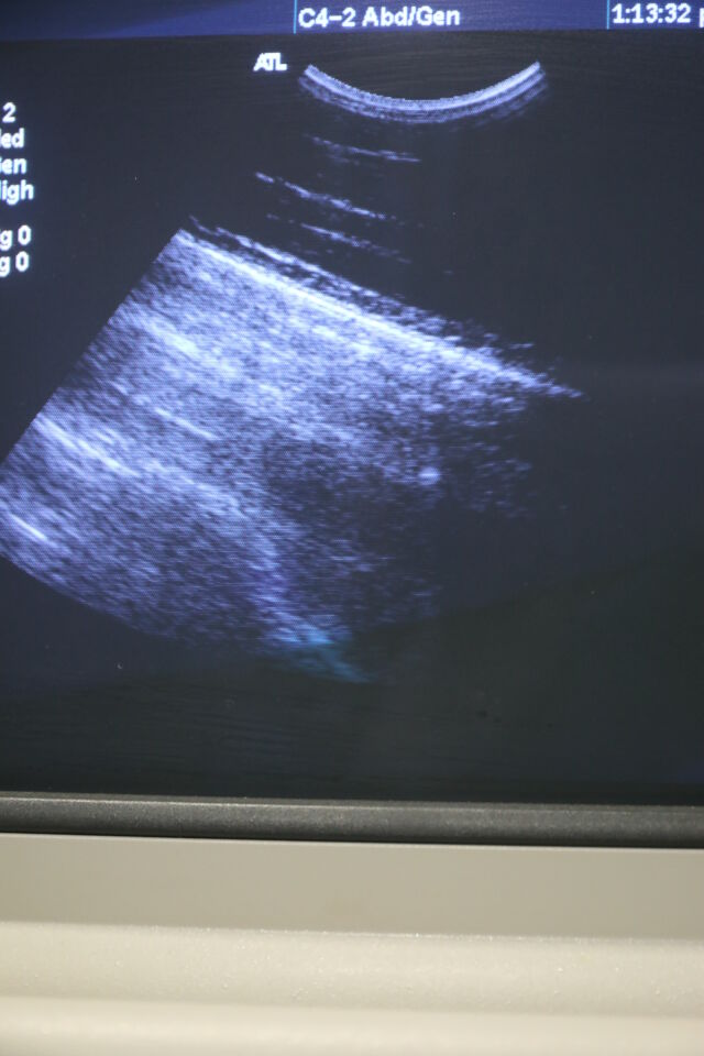 PHILIPS C4-2 Ultrasound Transducer