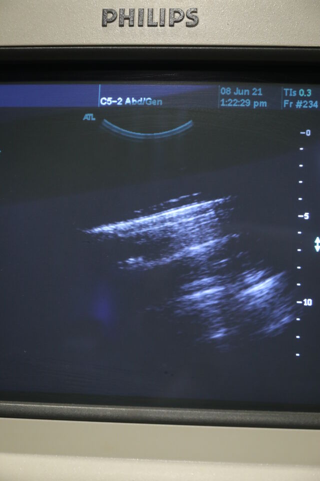 ATL C5-2 Ultrasound Transducer