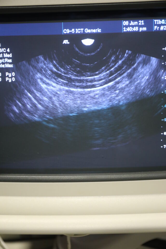 PHILIPS C9-5 Ultrasound Transducer