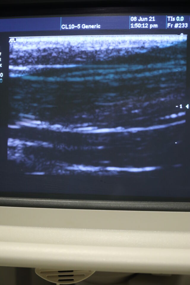 ATL CL10-5 Ultrasound Transducer