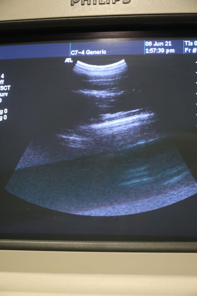 ATL C7-4 Ultrasound Transducer