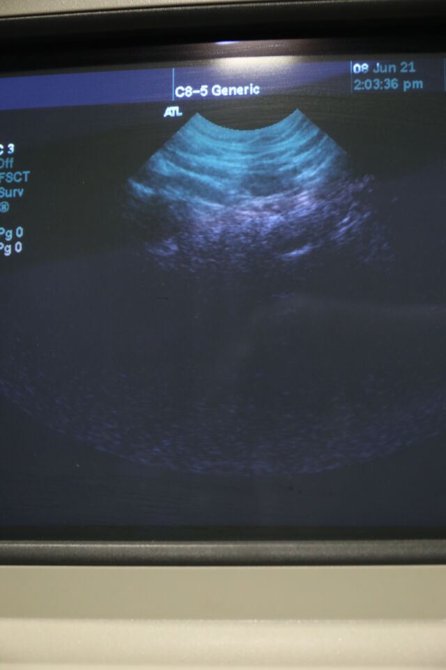 ATL C8-5 Ultrasound Transducer