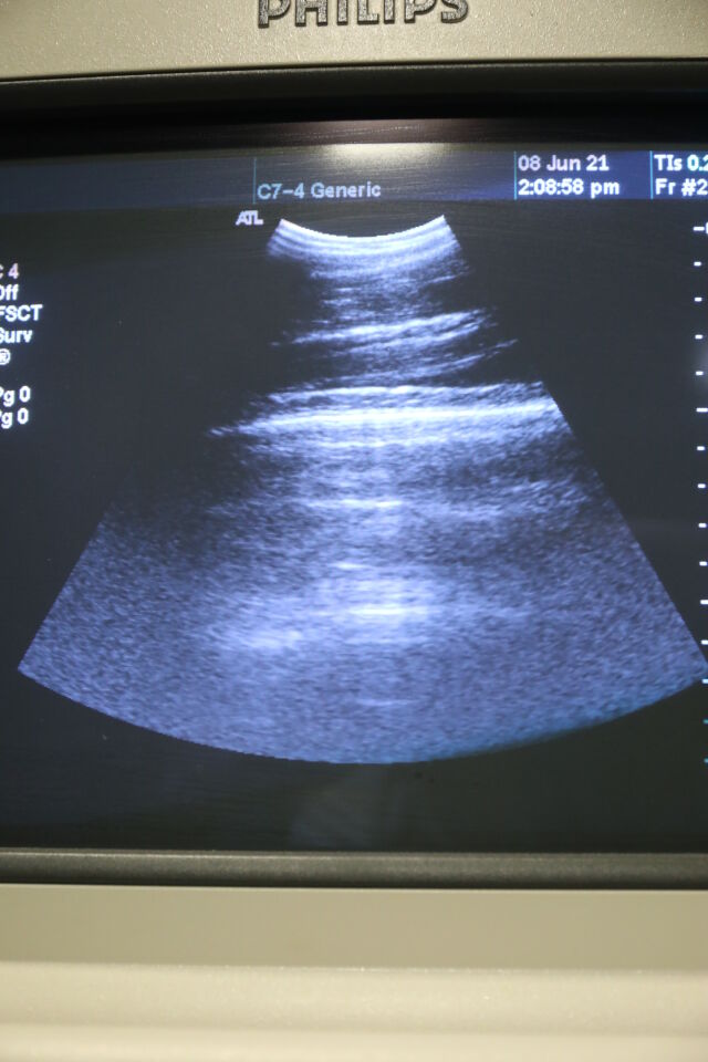 PHILIPS C7-4 Ultrasound Transducer