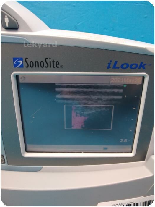 SONOSITE iLook 25 Portable Ultrasound Machine