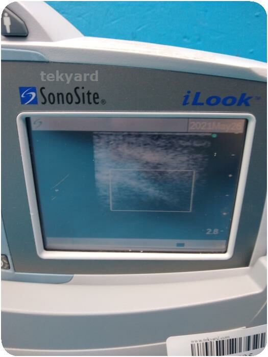SONOSITE iLook 25 Portable Ultrasound Machine