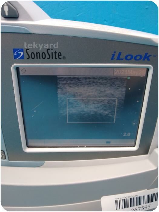 SONOSITE iLook 25 Portable Ultrasound Machine