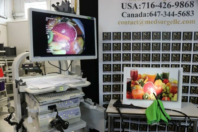 OLYMPUS GIF1TQ160 Gastroscope
