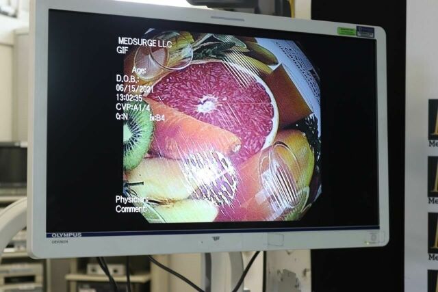 OLYMPUS GIF1TQ160 Gastroscope